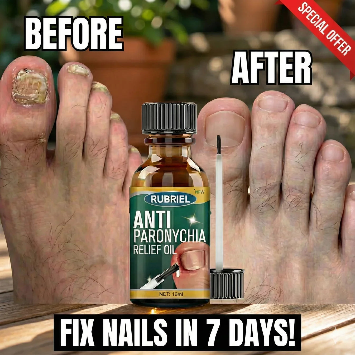 Anti Paronychia Relief Oil - (Buy_1_Get_1 _FREE)◽️◽️