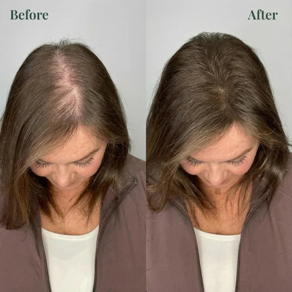 Kerarose Rosemary Shampoo For Hair Growth ( Buy 1 Get 1 Free 🔥)