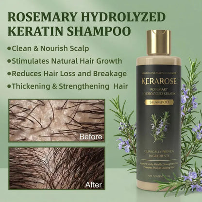 Kerarose Rosemary Shampoo For Hair Growth ( Buy 1 Get 1 Free 🔥)