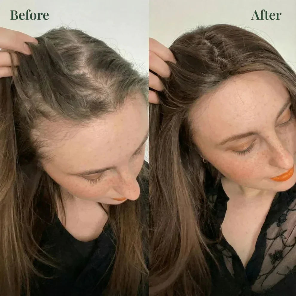 Kerarose Rosemary Shampoo For Hair Growth ( Buy 1 Get 1 Free 🔥)